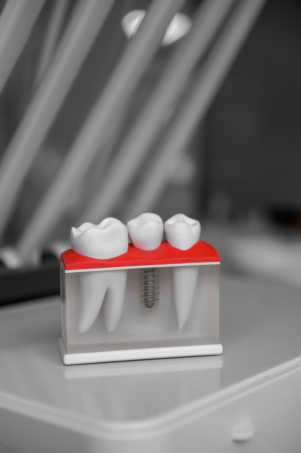 cosmetic dental tools